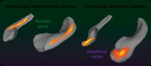 Dentate gyrus