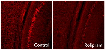 Rolipram activates the brain's garbage disposal system, eliminating excess Tau proteins (glowing red dots) associated with neurodegenerative diseases such as Alzheimer's.