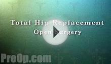 Hip Replacement Surgery - PreOp Patient Education Medical HD